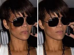 rihanna bruises