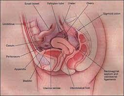 Treatment of Endometriosis.