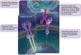 Herceptin in Breast Cancer