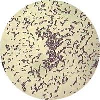 Listeria Symptoms Pregnancy