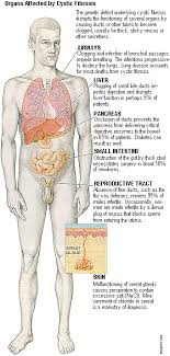 by cystic fibrosis