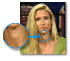 Ann Coulter Adams Apple