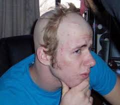 haircut gone wrong