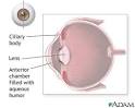 Ciliary body: MedlinePlus Medical Encyclopedia Image