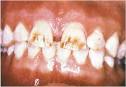 http://www.waybuilder.net/sweethaven/medtech/dental/ompath/fig0215.jpg