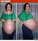 Picture: Octomom PHOTO One
