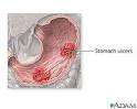 <b>Stomach disease</b> or trauma