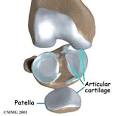 Cartilage Injuries