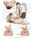 Cardiopulmonary Arrest and Treatment - External Resuscitation ...