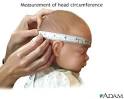 Head circumference