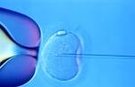 California IVF Davis Fertility Center, Inc.: Why is in vitro ...