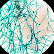 <b>Cyanobacteria</b>