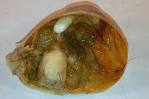 teratoma ��� lauren frances evans