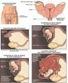 Is The Development Of Your Fetus Outside The Uterus? Facts About ...