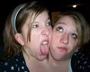 Abigail and Brittany Hensel: