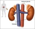 Adrenal Gland Disorders