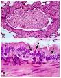 Canine distemper - Wikipedia, the free encyclopedia
