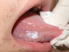 Alguns exemplos de <b>doenças</b> da