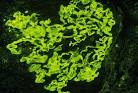 on the <b>glomerular basement</b>