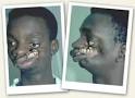 plastic surgery africa