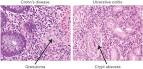 and <b>epithelioid cells</b>.