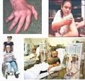 Autoimmune disorders