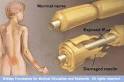 Guillain-Barre Syndrome (GBS) - i care