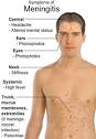 <b>Meningitis</b> may be caused by