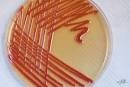 <b>Serratia Marcescens</b> in a petri