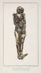 Visible Proofs: Forensic Views of the Body: Galleries: Biographies ...