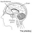 <b>Prolactinomas</b> can be treated