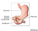 Janelle's Blog.: Duodenum