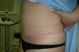 http://t1.gstatic.com/images?q=tbn:ANd9GcQHIwurbskjl0ihYxPIBVZ_Rqb5CnOU3gMV7tGVV4Eao4DZCHfuzA