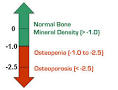 DEXA Scan - Bone Density Test