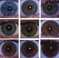 No Single Gene For Eye Color, Researchers Prove