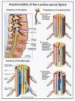 Epidural Steroid Injections