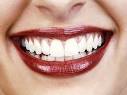 teeth whitening treatment
