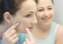  Treatment For Acne   Acne Treatment Guide
