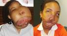 girl who survived 18-pound