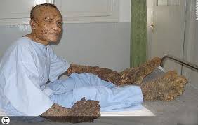 images?q=tbn:ANd9GcQLBa5Nmo7xnYxAnvUgYU3dRpoKKCYmJfTcsubx6LD-4pyxW3Wq&t=1