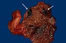 Forensic Pathology
