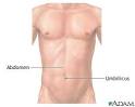 Normal external <b>abdomen</b>: