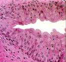 Exercise 4: Epithelium
