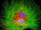 Encephalitis Virus, California; California encephalitis virus ...