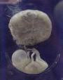 Fetus - Wikipedia, the free encyclopedia
