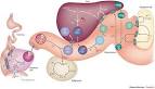 Plasma <b>lipoproteins</b>: genetic