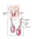 AUAF - Urology A-Z - Testicular Torsion