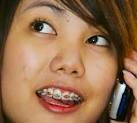 Deadly Fashion Braces Are Big