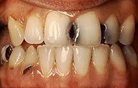 http://t1.gstatic.com/images?q=tbn:ANd9GcQQhMLf6NOFdC-5mYRXB4fpmWrjvG3XaO_C2cJ7NCntHGEIlJRfPw