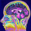 Vital Signs: The Swirling Myths of "Brain Death"